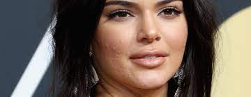 Check spelling or type a new query. Kendall Jenner Says Suffering From Acne Was Debilitating For Her Glamour