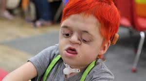 Farmington nonprofit gifts Massachusetts girl with custom shoes