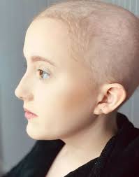 Glasgow dad opens up as gymnast daughter's 'growing pains' lead to cancer  diagnosis