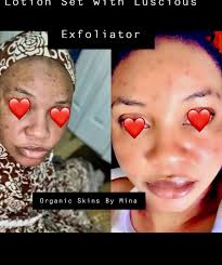 Instagram: @organicskincarebymina Facebook: Organic Skincare By MINA  TikTok: Organic Skincare By MINA Snapchat: @Mina_Ous Site:  organicskinsbymina.com USA: +19014621006 Dakar: 781818989 Gambie:  +2202003334