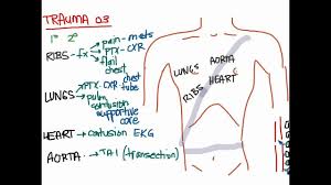 Image result for Chest Trauma