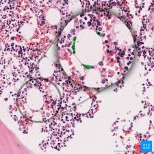 Slide 33 (skin, verhoeff stain) view virtual slide. Bone Marrow Histology Types And Features Kenhub