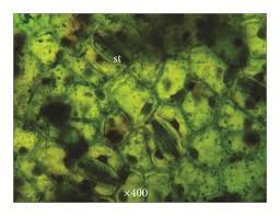 Image result for Phragmanthera capitata