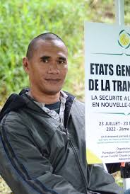 Image result for Oedina