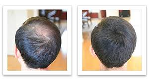 Look 10 years younger, in seconds. Amazon Com Caboki Hair Loss Concealer Color Blonde 30g 90 Day Supply Beauty