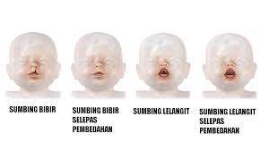 View the profiles of people named barah otak. Kanser Otak Punca Simptom Dan Rawatan The Diagnosa