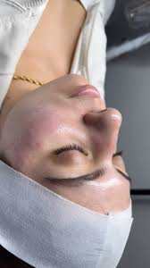 Dermaplaning + Hydra-facial! ✨ Dermaplaning exfoliates and removes dead  skin cells, leaving your face smooth and soft, while Hydrafacial deeply  hydrates and nourishes, giving you a beautiful glow. ...