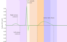 The Cardiac Cycle Deranged Physiology