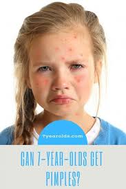 Pimples Can Be Such An Annoying Thing For Adolescents And Even Adults But Can Children As Young As 7 Years Old Get Pi Pimples How To Clear Pimples 7 Year Olds