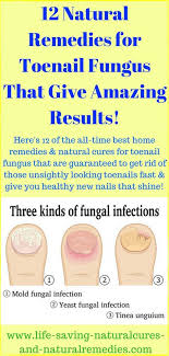 12 Home Remedies For Toenail Fungus That Give Amazing Results With Images Toenail Fungus Remedies Toenail Fungus Cure Toenail Fungus Removal
