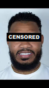 Que esperas para tu #diseñodesonrisa ? #carillasdentales #resinveneers  #before #after