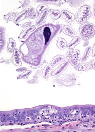 Image result for Lankesteria