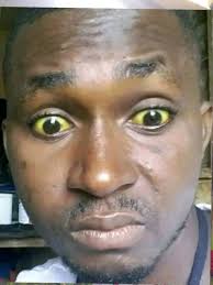 People sharing their eye problems and experiences