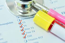 Image result for Thyroid Function Test