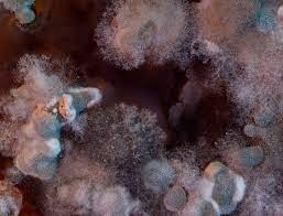 How mold exposure affects your health. How To Identify Hidden Mold Toxicity And What To Do About It