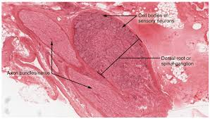 Diseases of the cranial nerves adams and victor's 13 2 Ganglia And Nerves Anatomy Physiology