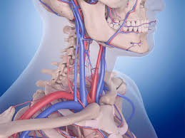 There are arteries in the neck as shown in the image. Preventing Stroke After Cervical Artery Dissection Medpage Today