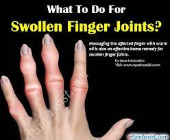 What To Do For Swollen Finger Joints?