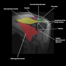 Image result for Shoulder MRI