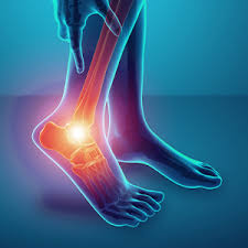 Maybe you would like to learn more about one of these? Gout 360 Suplemen Herba Untuk Gout