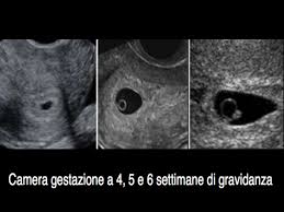 Quarta Settimana Di Gravidanza Tutto Quello Che Devi Sapere A Tutto Donna