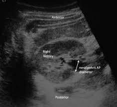 Pin On Urogenital