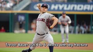 Trevor andrew bauer (born january 17, 1991) is an american professional baseball pitcher who is a free agent. Cleveland Indians Trevor Bauer Out 4 To 6 Weeks With Leg Fracture Wkyc Com
