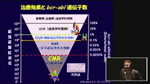 骨髄異形成症候群・慢性骨髄単球性白血病・急性骨髄性白血病に対するペボネディスタットの治験 治験の募集状況は、「医薬品情報データベース 臨床試験情報 」ページでご確認ください。 上記ページにアクセスし、条件欄から「試験の名称」を選択、このページの「試験概要詳細」の「試験. æ…¢æ€§éª¨é«„æ€§ç™½è¡€ç—…ã®è¨ºæ–­ æ²»ç™‚ã¨ä»Šå¾Œã«ã¤ã„ã¦ æœ¨æ' æ™‹ä¹Ÿ Youtube