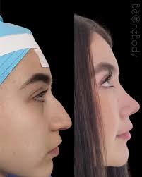 DERMATOLOGÍA•ESTÉTICA AVANZADA•CIRUGÍA ESTÉTICA •RINOPLASTIA (@beonebody) ·  Llanogrande, Colombia · Instagram photos and videos