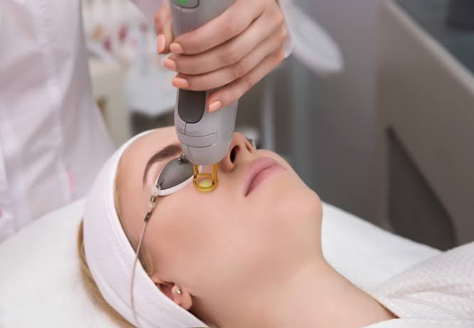 Laser Skin Resurfacing in Dieppe - Allura Clinic