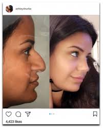 New York Plastic Surgeon