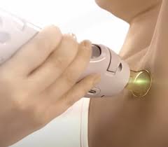 Laser hair removal is a safe and effective way to stop follicles from producing hair. Laser Hair Removal Knox Laser Skin Solutions