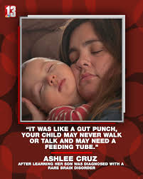 This 2-year-old, named Leo, suffers...