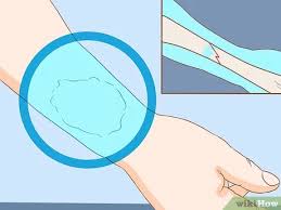 Faktor depresi pada remaja yakni gangguan mental spesifik seperti perasaan sedih, murung dan sebagainya yang bisa terjadi karena faktor luar dan dalam. Cara Mengidentifikasi Fraktur Dengan Gambar Wikihow