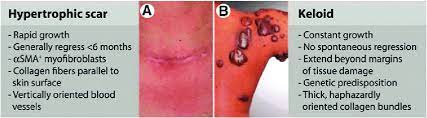 I have seen these in real life. Clinical Examples Of Scarring Pathologies A Hypertrophic Scar B Download Scientific Diagram