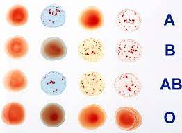 We did not find results for: Are You An A B Or O Or Even A Duffy Why You Should Know Your Blood Type Daily Mail Online
