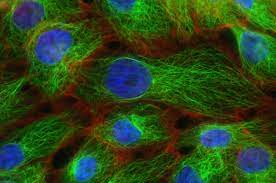 Breast cancer is on and i know that brain cancer is another and lung cancer. Spotting Breast Cancer S Spread To The Brain Before Symptoms Start Could Improve Survival