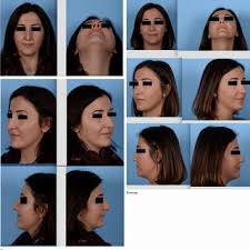 1) Não considero o meu primeiro resultado satisfatório e não sinto...