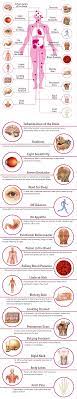 Meningitis: Symptoms, Causes, Types, Treatment, Risks, Vaccine