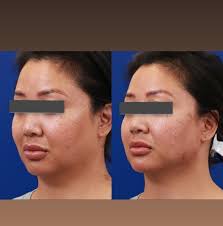 Northwest Aesthetics (@northwestaesthetics) • Facebook