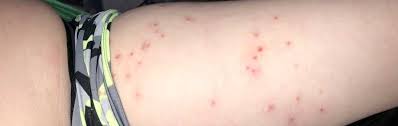 It was first identified in december 2019 in wuhan,. This Is Also Covid Woman Says Her 8 Year Old Tested Positive For Covid 19 Displayed Unusual Symptoms