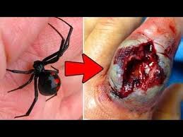 Resultado de imagem para aranha mais perigosa do mundo