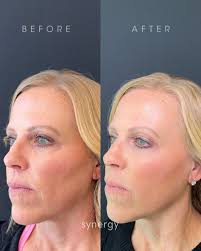 ✨Meet laser specialist, Vickie✨ We're proud to have such passionate and  dedicated providers, such as Vickie! Vickie has been in the aesthetics  industry for 15 years specializing in laser therapy. She started