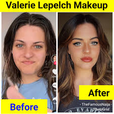 Valerie Lepelch Before And After Face Photos 6336 | Hot Sex Picture