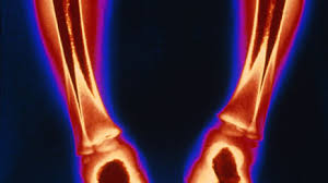 Portal pharmacy is a trusted online pharmacy store with 100% authentic medicines since 1961. Reversing Vitamin D Deficiency In Infants Clinical Advisor