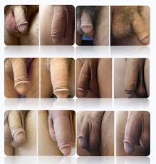 Fotos antes y después alargamiento de pene - Estética del pene