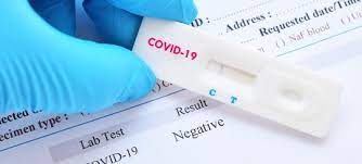 Find your closest ontario testing location to get a covid‑19 test. Antistoff Hurtigtest Oppdatert Rapport Klar Noklus No