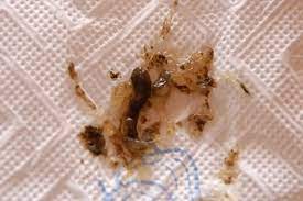 Urin Und Kottelkunde