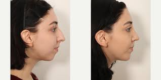 Benjamin C. Paul, MD, Board Certified Facial Plastic Surgeon