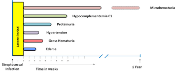 Lecture in internal medicine for v course students. Acute Glomerular Diseases In Children Fulltext
